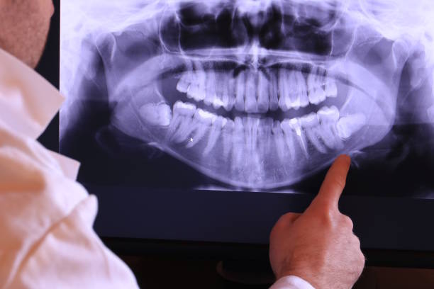 Best Emergency Dental Services for Seniors in Gibbstown, NJ