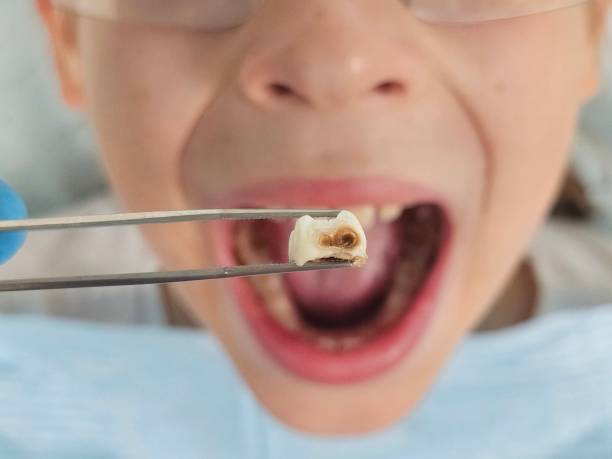 Best Orthodontic Emergency Dentist in Gibbstown, NJ